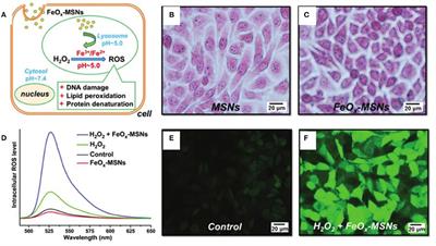 Ferrite Nanoparticles-Based Reactive Oxygen Species-Mediated Cancer Therapy